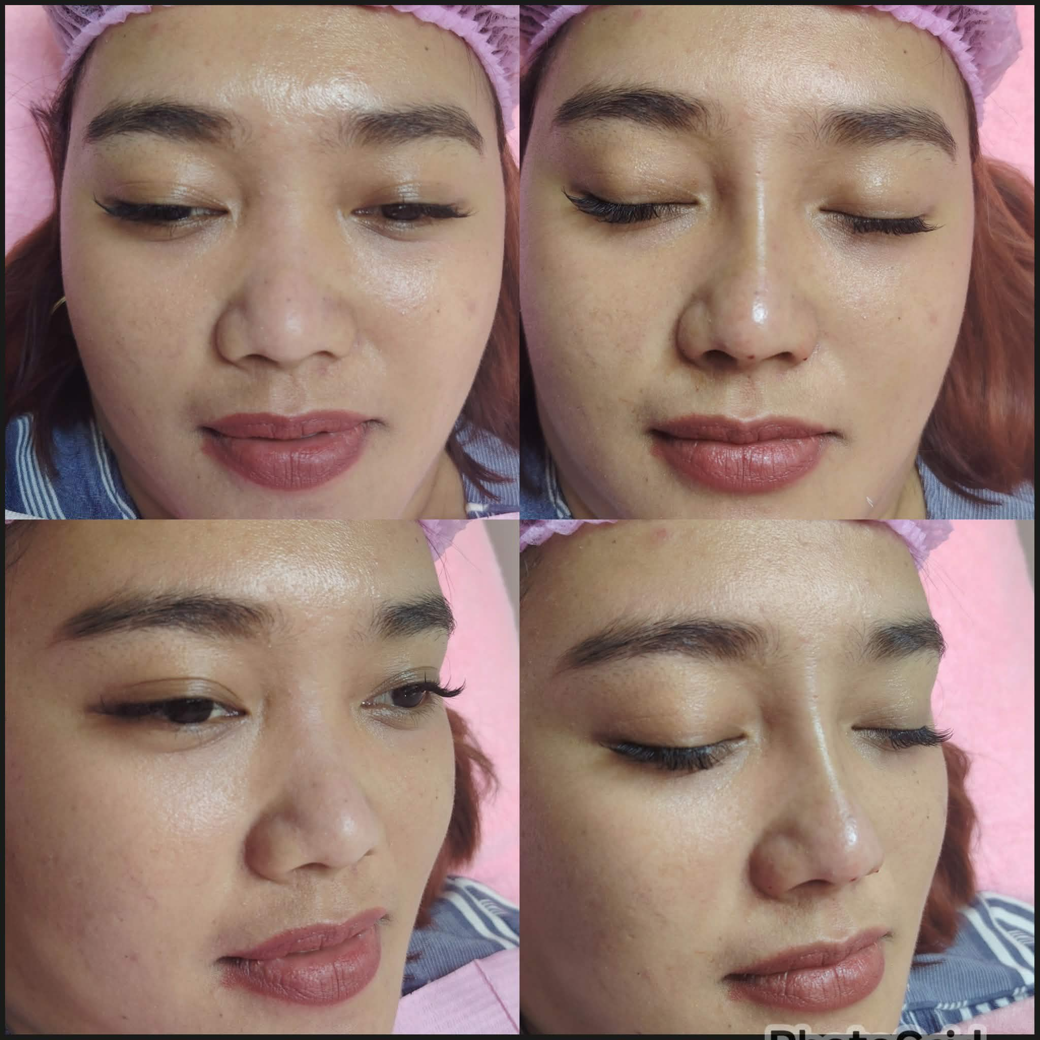 Nose enhancement result